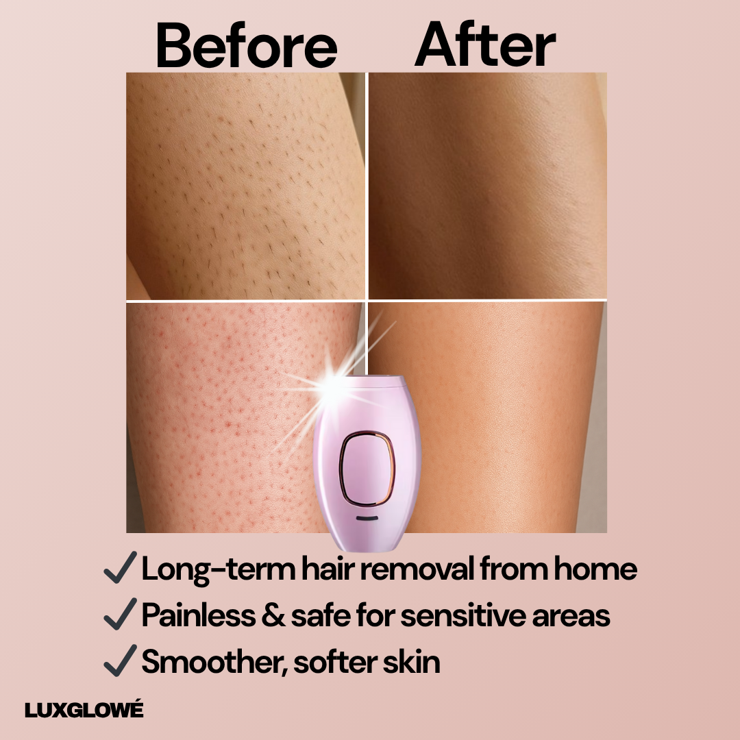 LuxGlowé IPL Hair Removal Device
