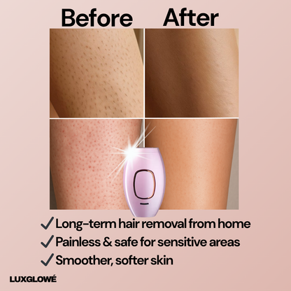 LuxGlowé IPL Hair Removal Device